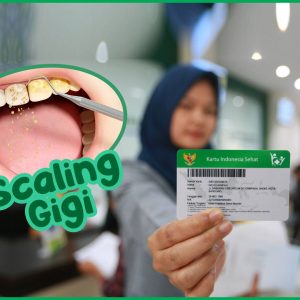 Apakah Bersihkan Karang Gigi Bisa Pakai BPJS? Ini Syarat dan Prosedurnya!