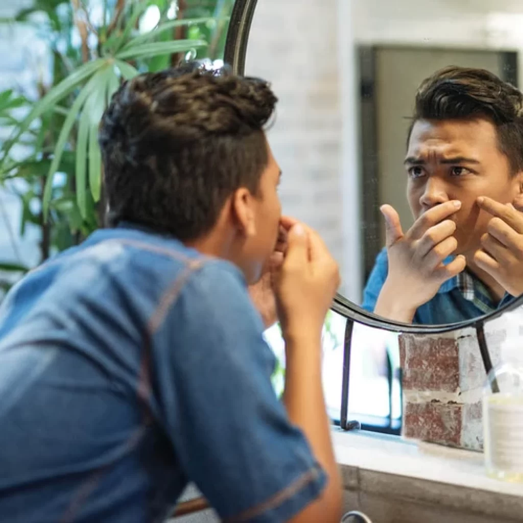 Kenali 6 Jenis Jerawat & Cara Ampuh Mengobatinya