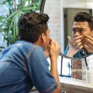 Kenali 6 Jenis Jerawat & Cara Ampuh Mengobatinya